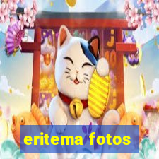 eritema fotos